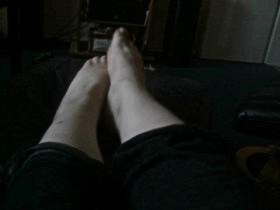 My hot feet