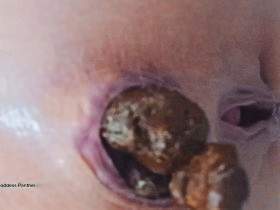 Hard Strain Poop