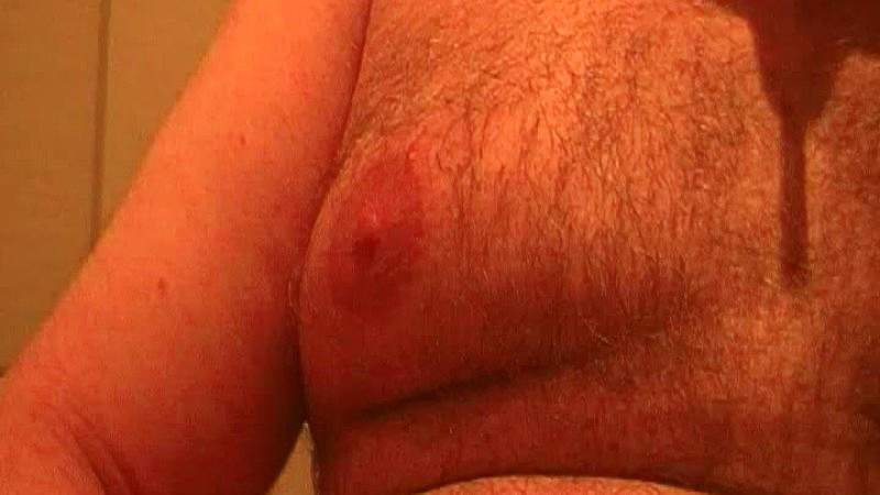 Pflegerin Schulmaedchen Brustwarzen Fisten