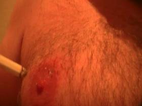 Nipple *******