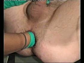 Patient Anal gefisted