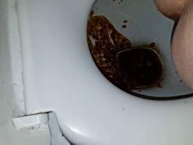 Diarrhea into the toilet