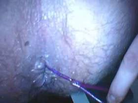 Balls