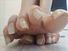 Addictive Lotion Toenails