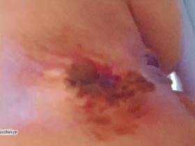 3 Fat Doses Of Shit