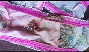 oh no! i poop in my pink my lil pony's panty