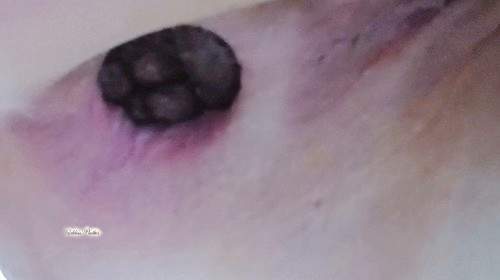 Strain Huge Poop
