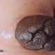 Double Fat Constipated Portion