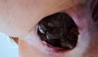 ASMR Huge Turds In Your Mouth
