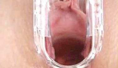 Speculum in Fotze und Arschfotze