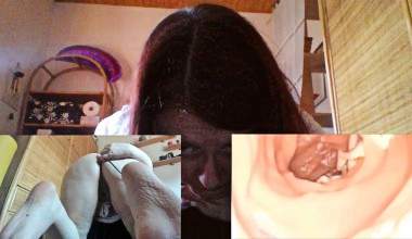 Anal Vore Endoskop Sitzung - Wie ein Parasit