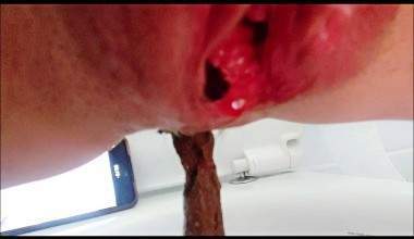 my anus has to widen for this big poop to pass!