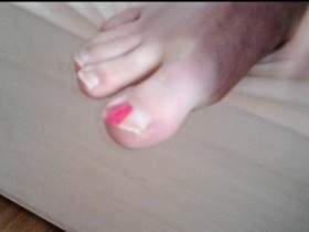 Painted toenails - Right