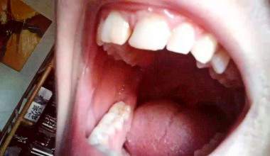 In meinem dreckigen Mund