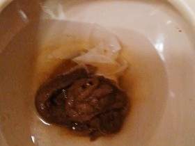 Shit has to go through the KLO hole, is it?!?!