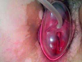 Pussy pump Toymasturbation on Period