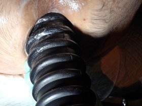 Extremely stretched anal canal with huge grooved dildo and textured glove