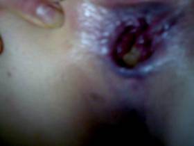 Vorschaubild vom Privatporno mit dem Titel "Kann nicht scheissen2" von sexyvenushuegel