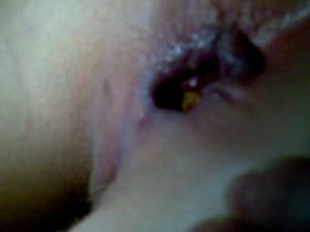 Vorschaubild vom Privatporno mit dem Titel "Ich kann einfach nicht scheissen1" von sexyvenushuegel