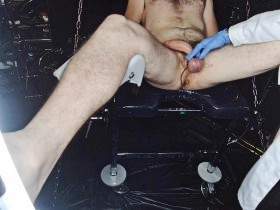 Needling straight through your balls!