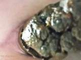3 Massive Poops