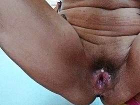 Bone-dry bolt birth, then obstetrics, finger pulls out shit