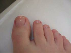 Toenails painted for the summer