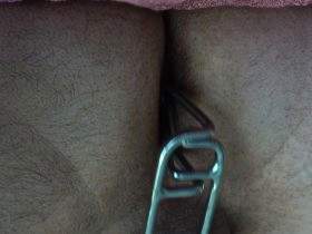 Deep block with the anal spreader