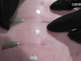 Vorschaubild vom Privatporno mit dem Titel "Das Nadelkorsett - Bizarre Schönheit" von CherieNoir