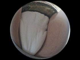 Big diaper fisheye