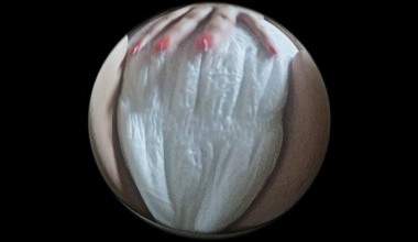 Big Windel Fischauge