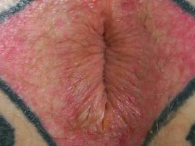My hole