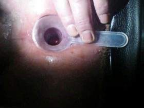 tiefe Einblicke in mein arscloch