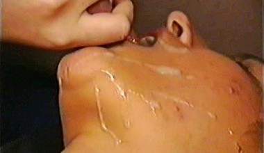 Cumshot Complications