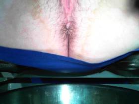 Looked into the rectum