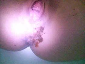 EM shit caviar mix clips