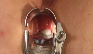 **ANALE BESAMUNG DURCH&#039;S SPEKULUM**