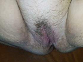 Injected into her pubic hair