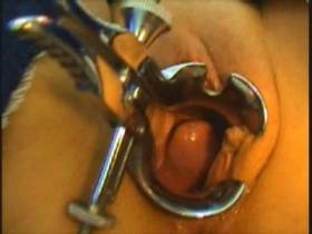 Vorschaubild vom Privatporno mit dem Titel "X-files : spekulum nahaufnahme" von Xtrem-Babe