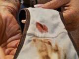Blutiger Slip, rumgeschmiere mit Blut Klumpen