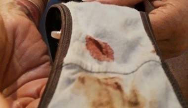 Blutiger Slip, rumgeschmiere mit Blut Klumpen
