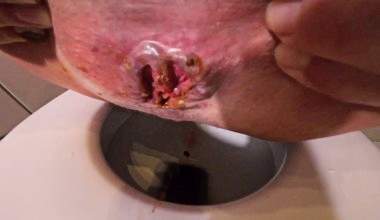 Härtestes Pressen bis zur Ohnmacht