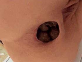 Fat Constipated Dose