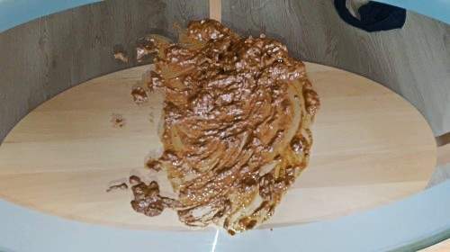 Scheisse von oben und unten