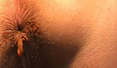 Ass Temperatur Scheiße