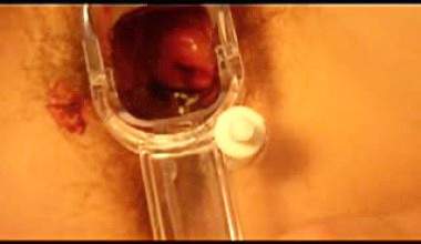 Spekulum und Dildoaction