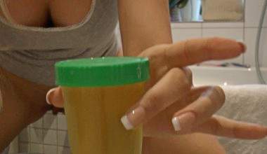 IN URINBECHER GEPISST   ÜBERRASCHUNG