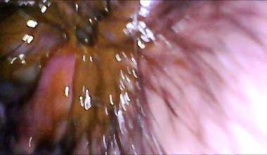 Neues Endoskop Big Poo