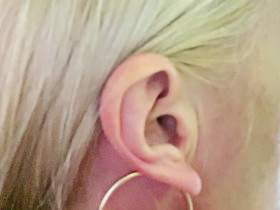 Painful Ear Piercing