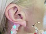 Painful Ear Piercing